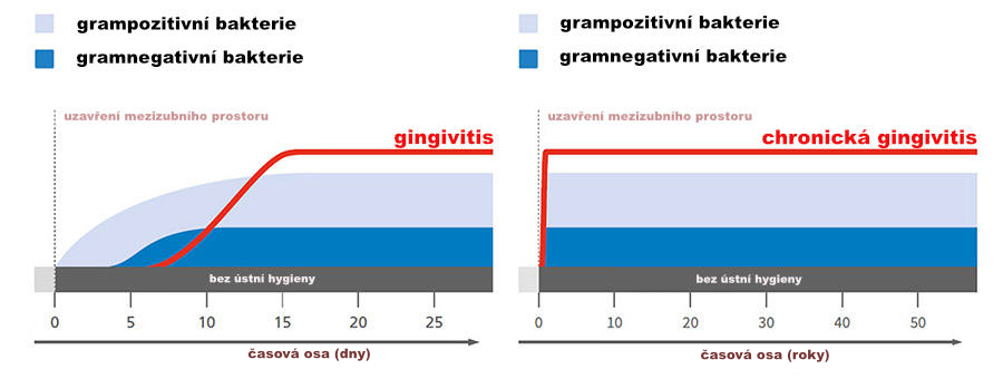 Gingivitis in man